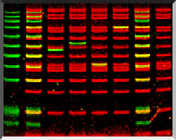 DNA bands on a gel